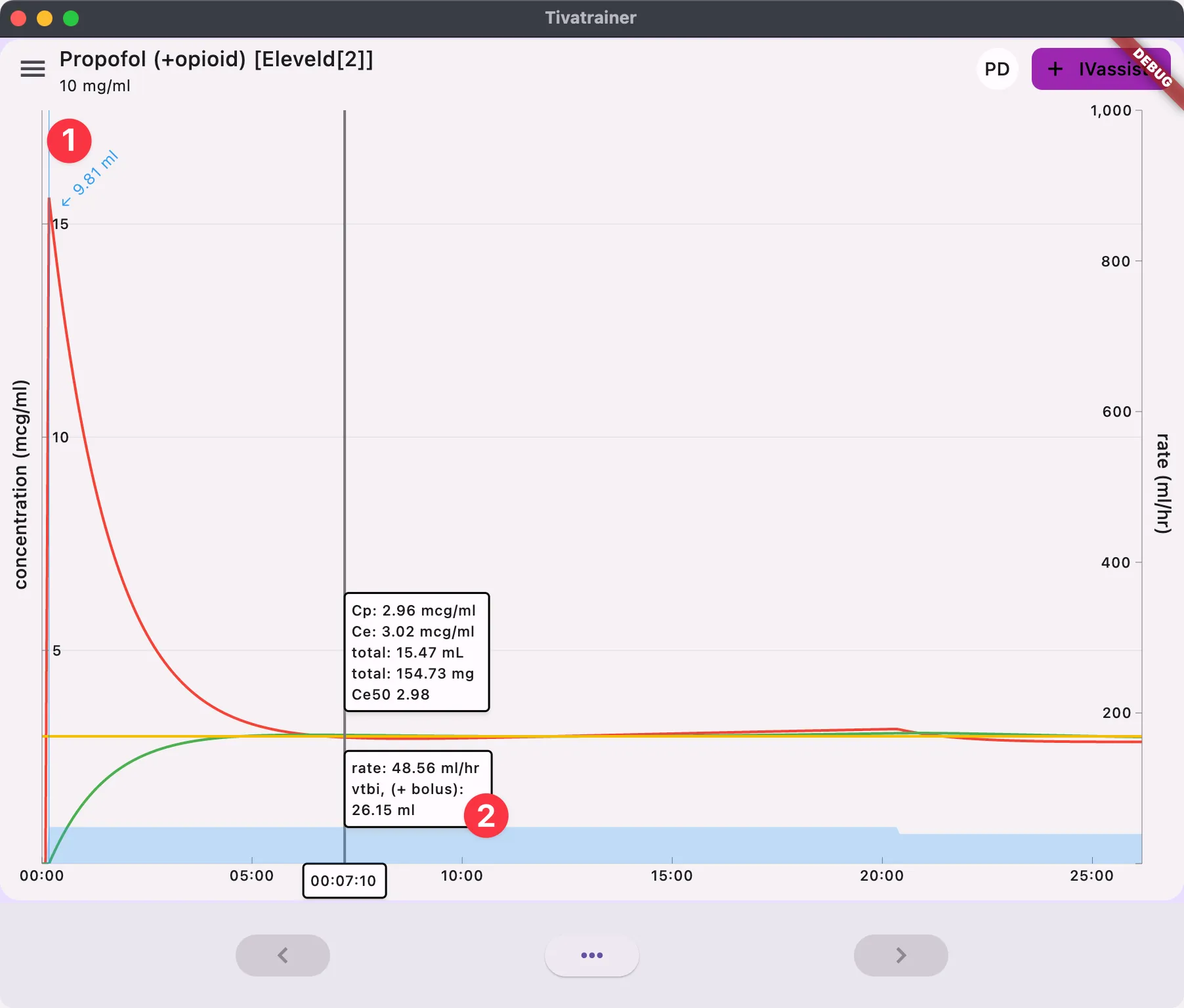 IVassist simulation